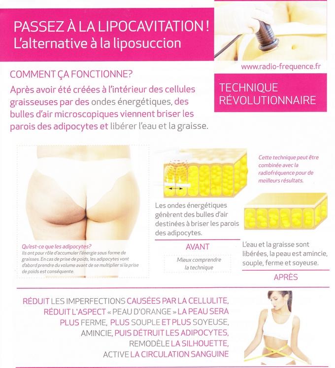 Lipocavitation jardin de la beaute